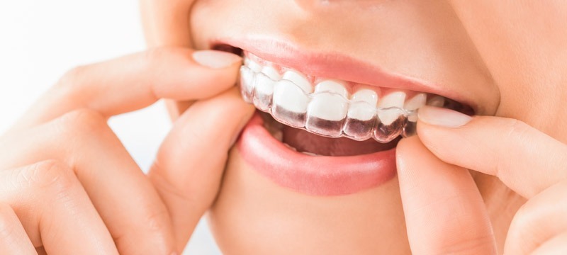 Orthodontist Edmonton