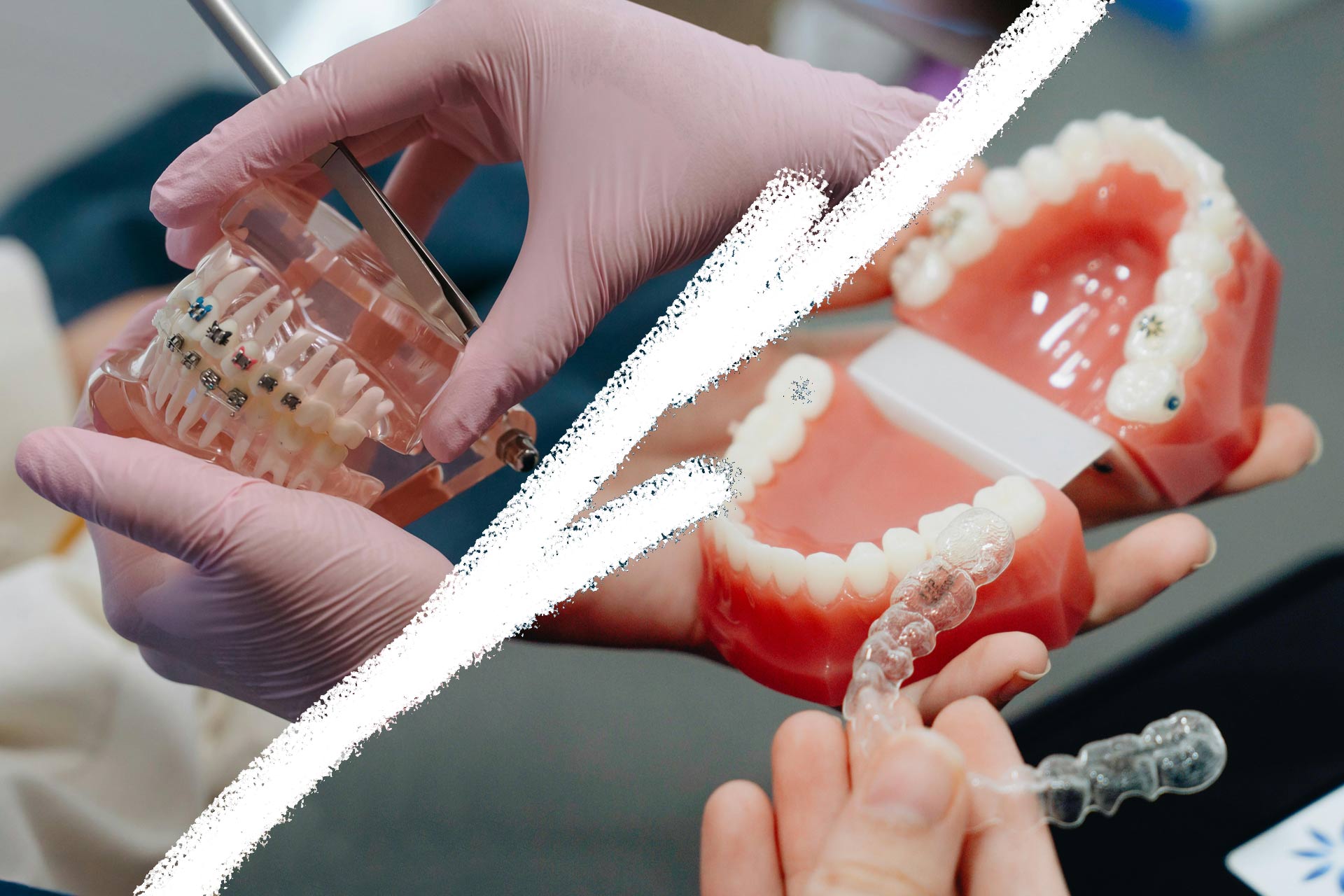 Teen orthodontics Hawthorn