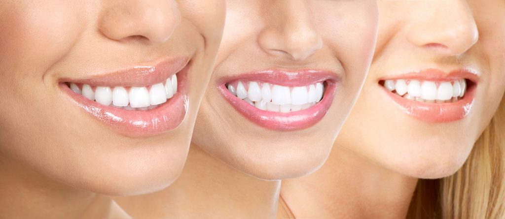 Teen orthodontics Hawthorn