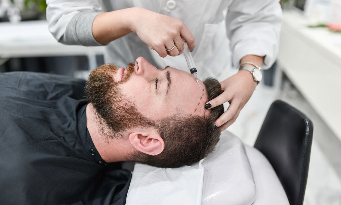 Hair transplant uk